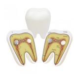 2100 *Muela de Plástico* (13 x10 cm.) 1 Pca.